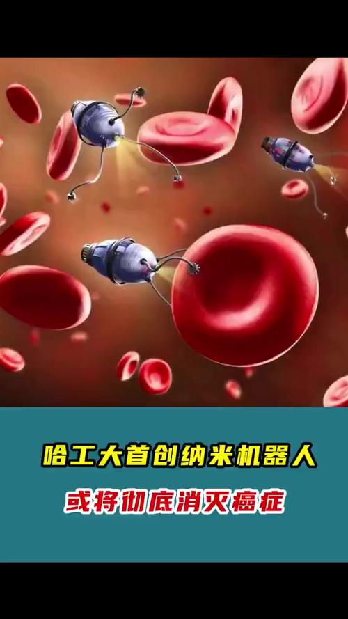 纳米机器人清除动脉斑块：预防心血管疾病