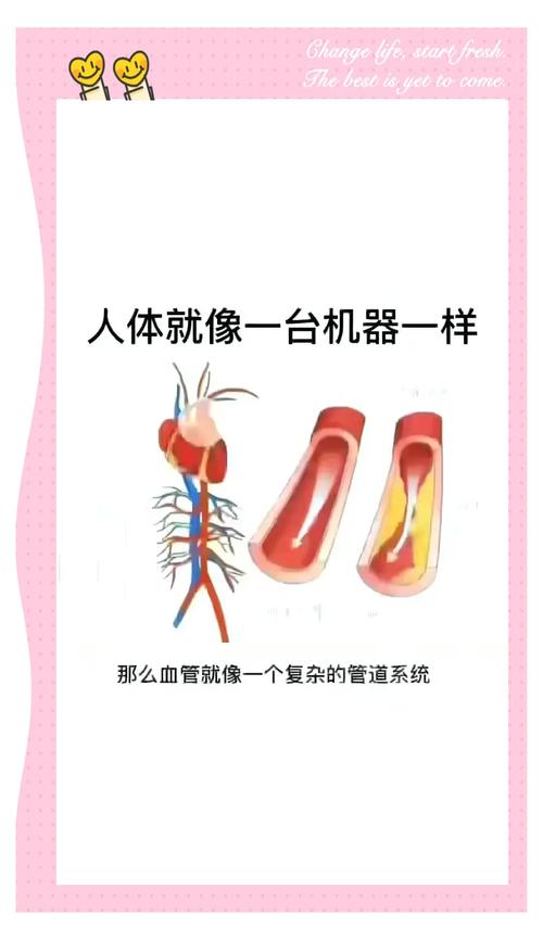 纳米机器人清除动脉粥样硬化:预防心血管病